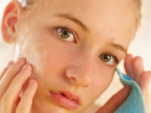 acne breakout pimples redness