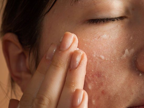 How To Shrink Large Pores